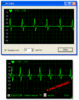 ekg-preview_212.gif